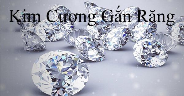 Kim Cương Gắn Răng